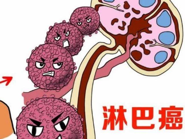 早期淋巴肿瘤的症状是什么呢